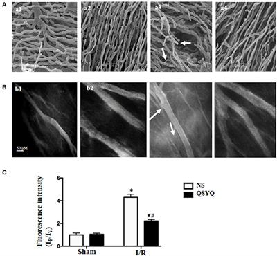 QiShenYiQi Pills Attenuates Ischemia/Reperfusion-Induced Cardiac Microvascular Hyperpermeability Implicating Src/Caveolin-1 and RhoA/ROCK/MLC Signaling